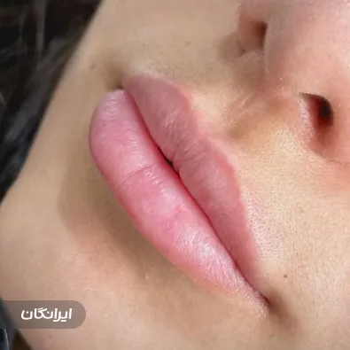 کلینیک زیبایی دکتر میترا رزمی