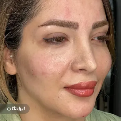 کلینیک زیبایی نیلا