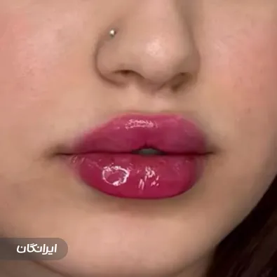 کلینیک زیبایی رویال
