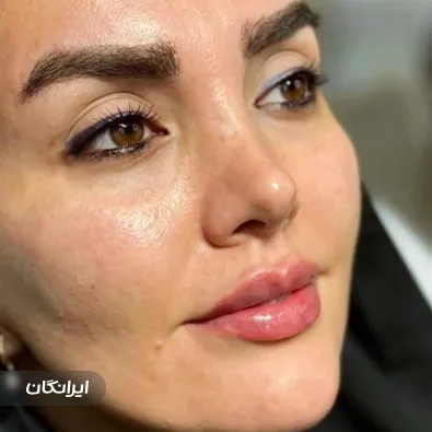 کلینیک زیبایی تینا