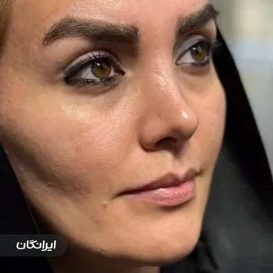 کلینیک زیبایی تینا