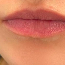 کلینیک زیبایی و لیزر نئوما