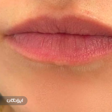 کلینیک زیبایی و لیزر نئوما