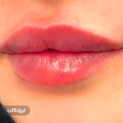 کلینیک زیبایی و لیزر نئوما