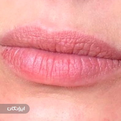 کلینیک زیبایی و لیزر نئوما
