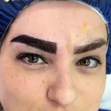 کلینیک کاشت مو تارکوب