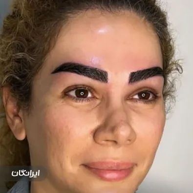 کلینیک کاشت مو تارکوب