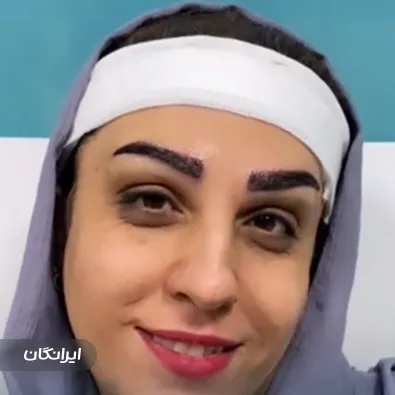 کلینیک کاشت مو تارکوب