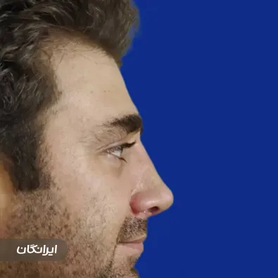 دکتر بابک مریدی