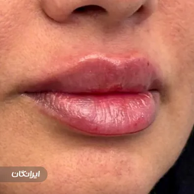 مطب زیبایی دکتر حبیب برناک