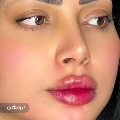 کلینیک زیبایی گونش