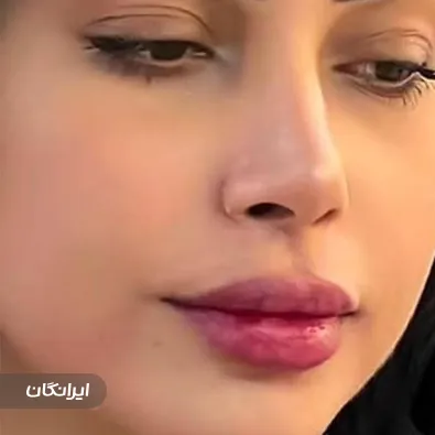 کلینیک زیبایی گونش