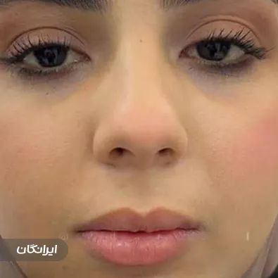 کلینیک زیبایی گونش