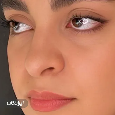 دکتر پارسا چراغی پور