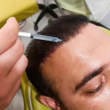 کارشناس کاشت مو مجید صبحی