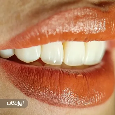 دندانپزشکی دکتر رضا احدزاده