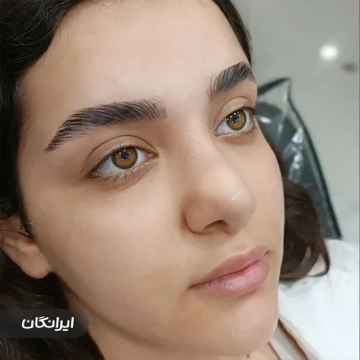 فیبروز آرتیست زهره نجفی