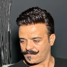 مرکز پروتز مو دلانا