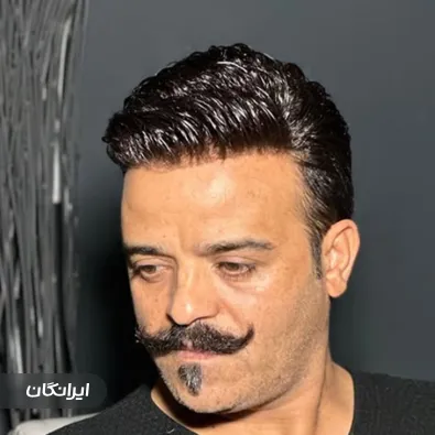 مرکز پروتز مو دلانا