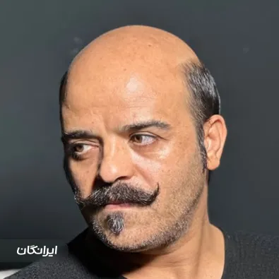 مرکز پروتز مو دلانا