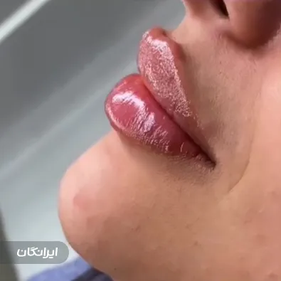 کلینیک زیبایی دکتر شهاب الدین خیاط زاده منشادی