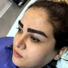 کارشناس کاشت مو حسین اورنگ