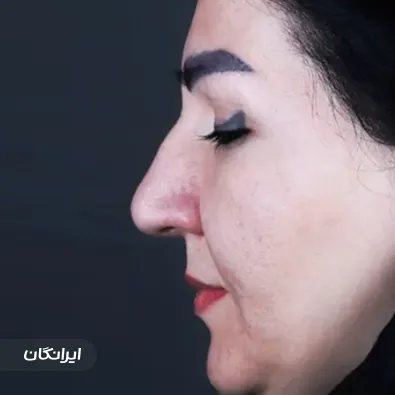 دکتر نازنین ابدالی