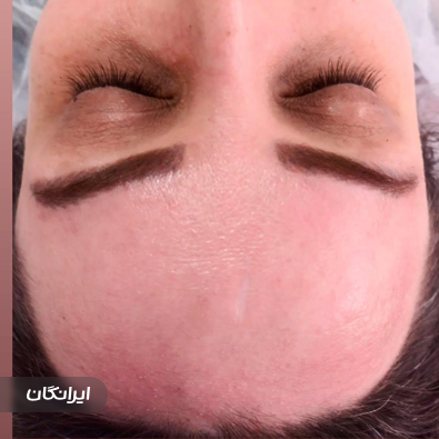 فیشیالیست حمیده علیزاده