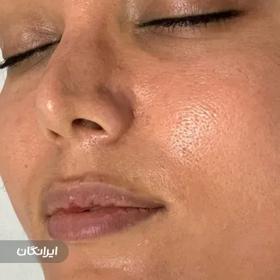 فیشیالیست الناز فرجی