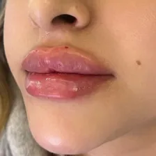 کلینیک زیبایی دکتر زرین بادینی