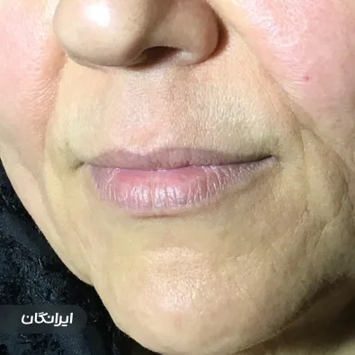 کلینیک زیبایی دکتر زرین بادینی