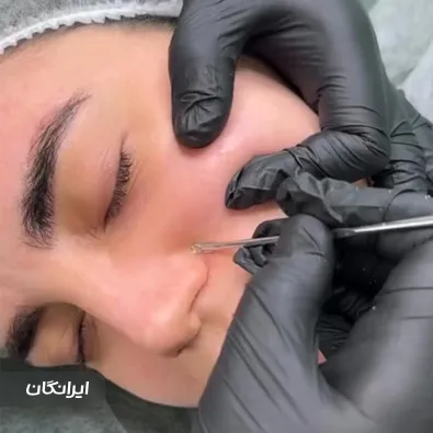 فیشیالیست سارا قلی زاده