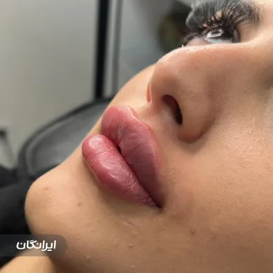 کلینیک زیبایی آرمینه