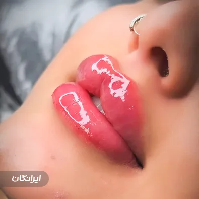 کلینیک زیبایی آرمینه