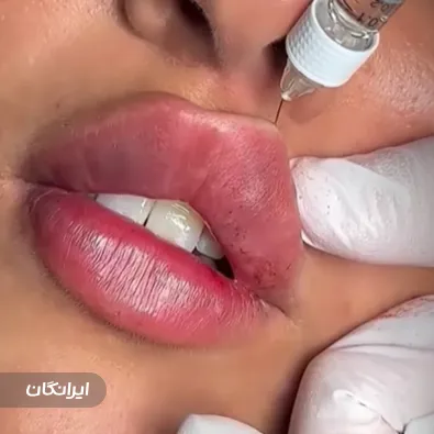 کلینیک زیبایی رز طلایی