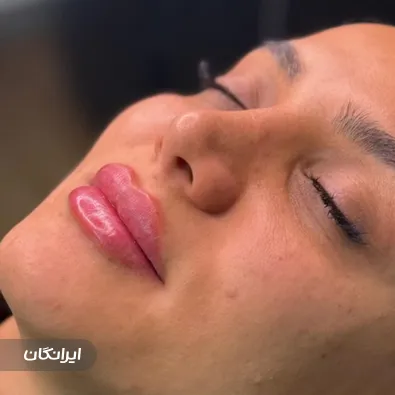 ‏مرکز ژل و بوتاکس حانیه حسین پور