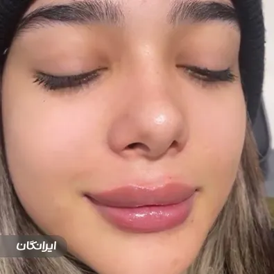 ‏مرکز ژل و بوتاکس حانیه حسین پور