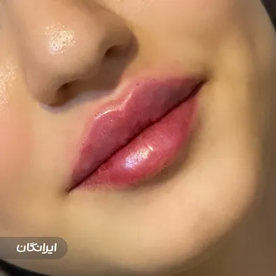 کلینیک زیبایی سمیرا