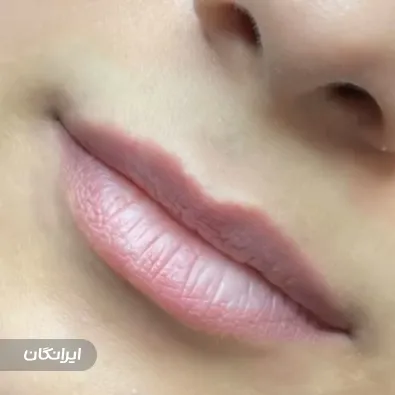 کلینیک زیبایی سمیرا