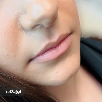 کلینیک زیبایی دکتر مهرنوش احمدی باروق