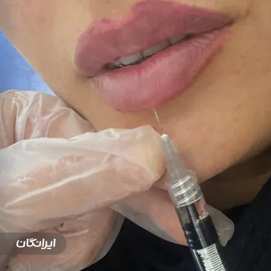 کلینیک زیبایی افرا