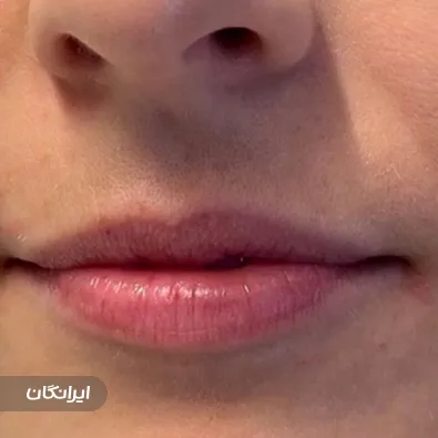 کلینیک زیبایی افرا