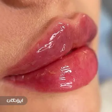 کلینیک زیبایی افرا