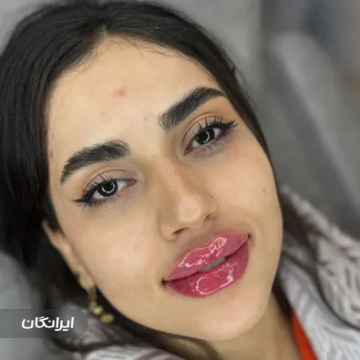 کلینیک زیبایی گلین