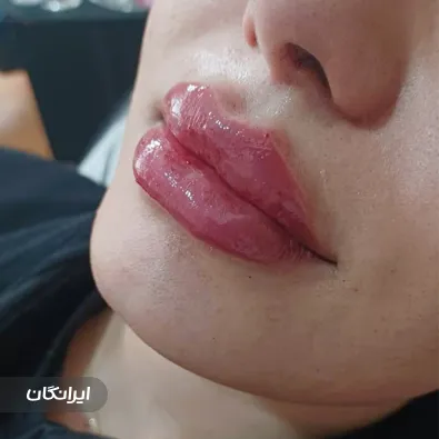 کلینیک زیبایی غزل فیضی