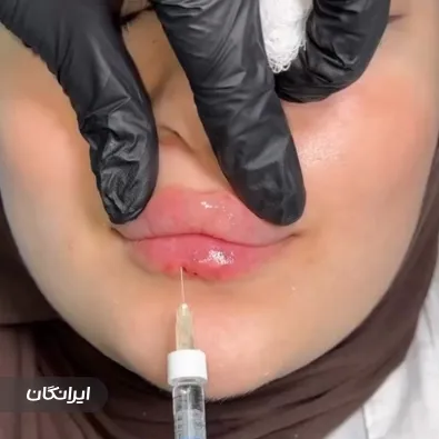 کلینیک زیبایی روشن جعفری