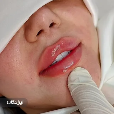 کلینیک زیبایی تیما