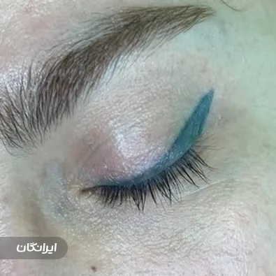 کلینیک زیبایی لونا