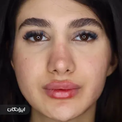 کلینیک زیبایی طلا