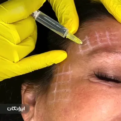 کلینیک زیبایی الناز